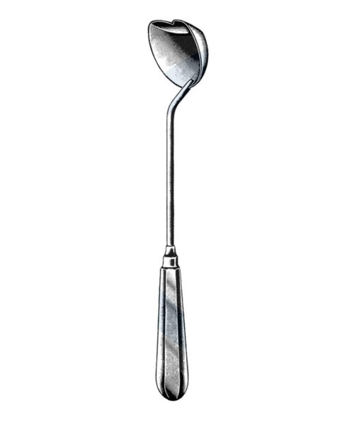 Moore Gall Stone Scoop 11 (28 cm)